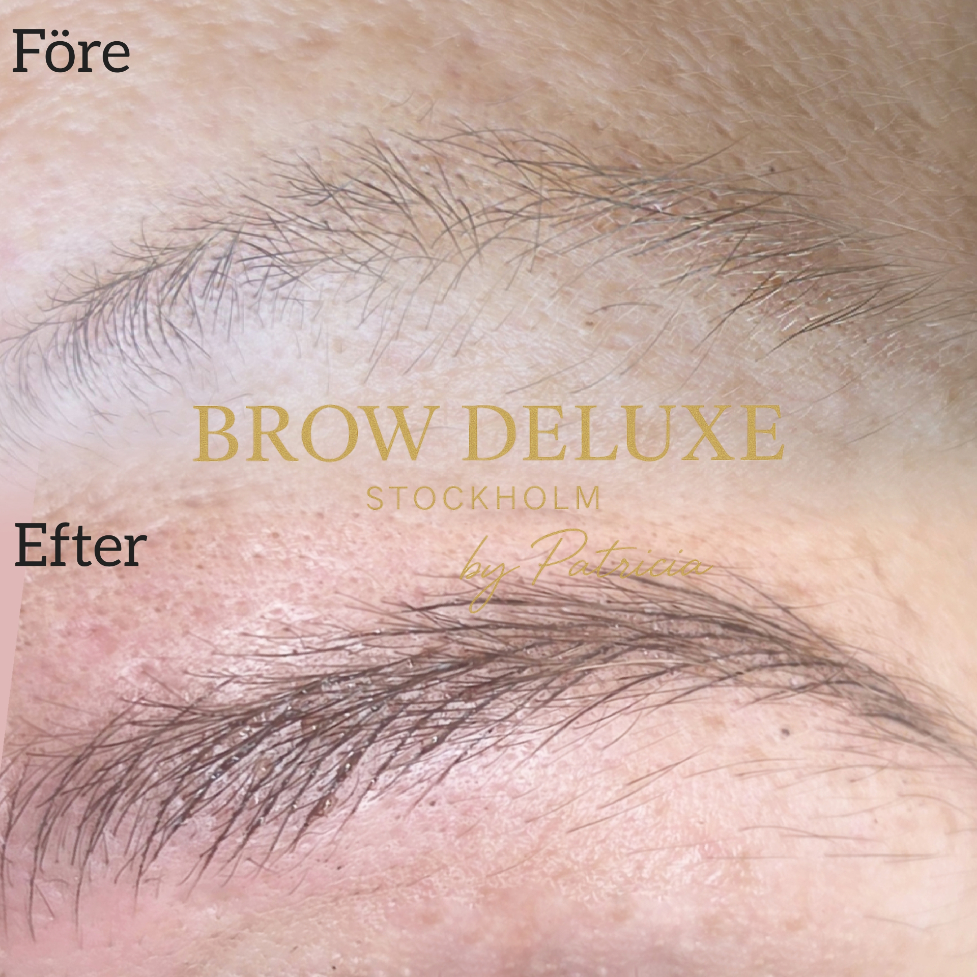 Resultat — Microblading
