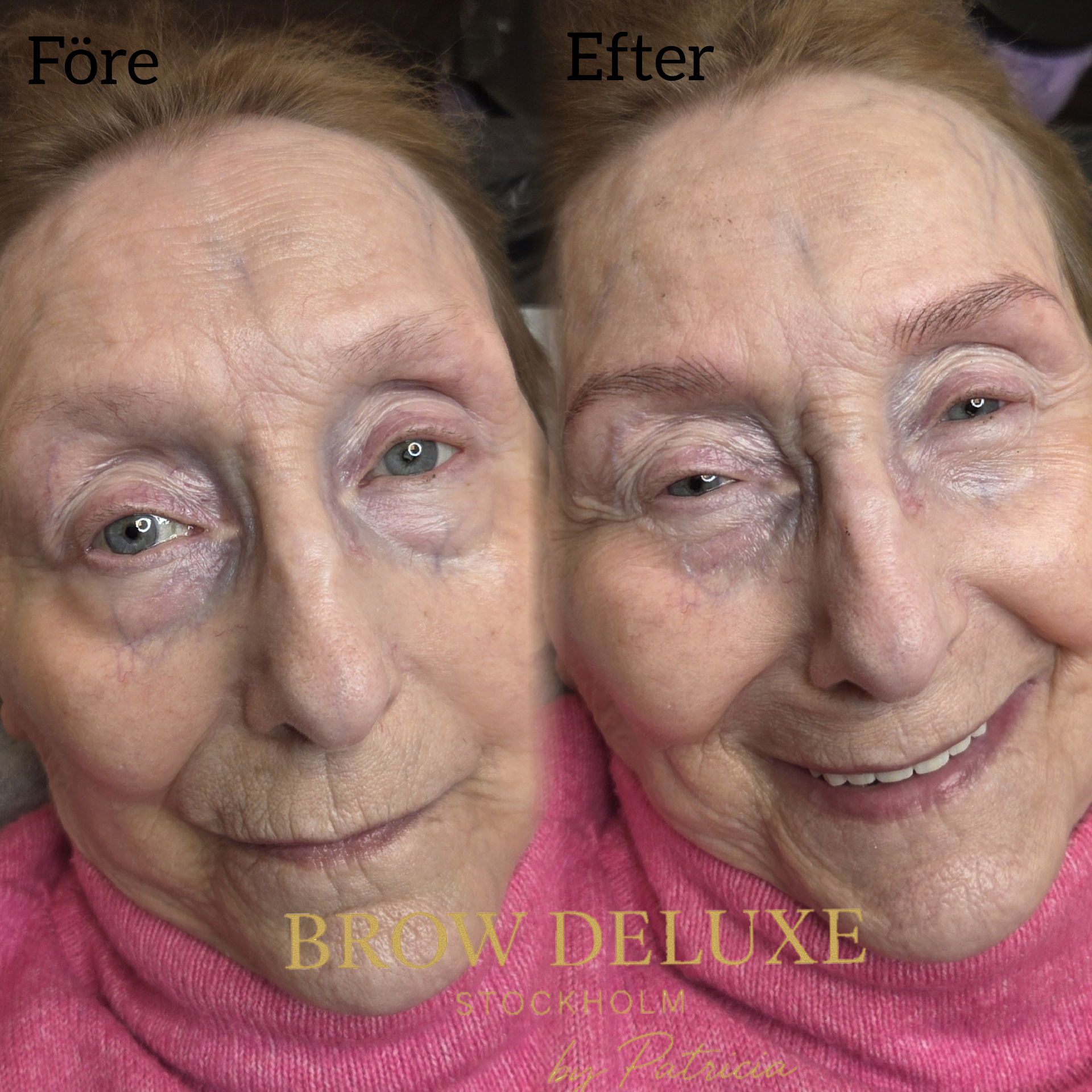 Resultat — Brow Restoration